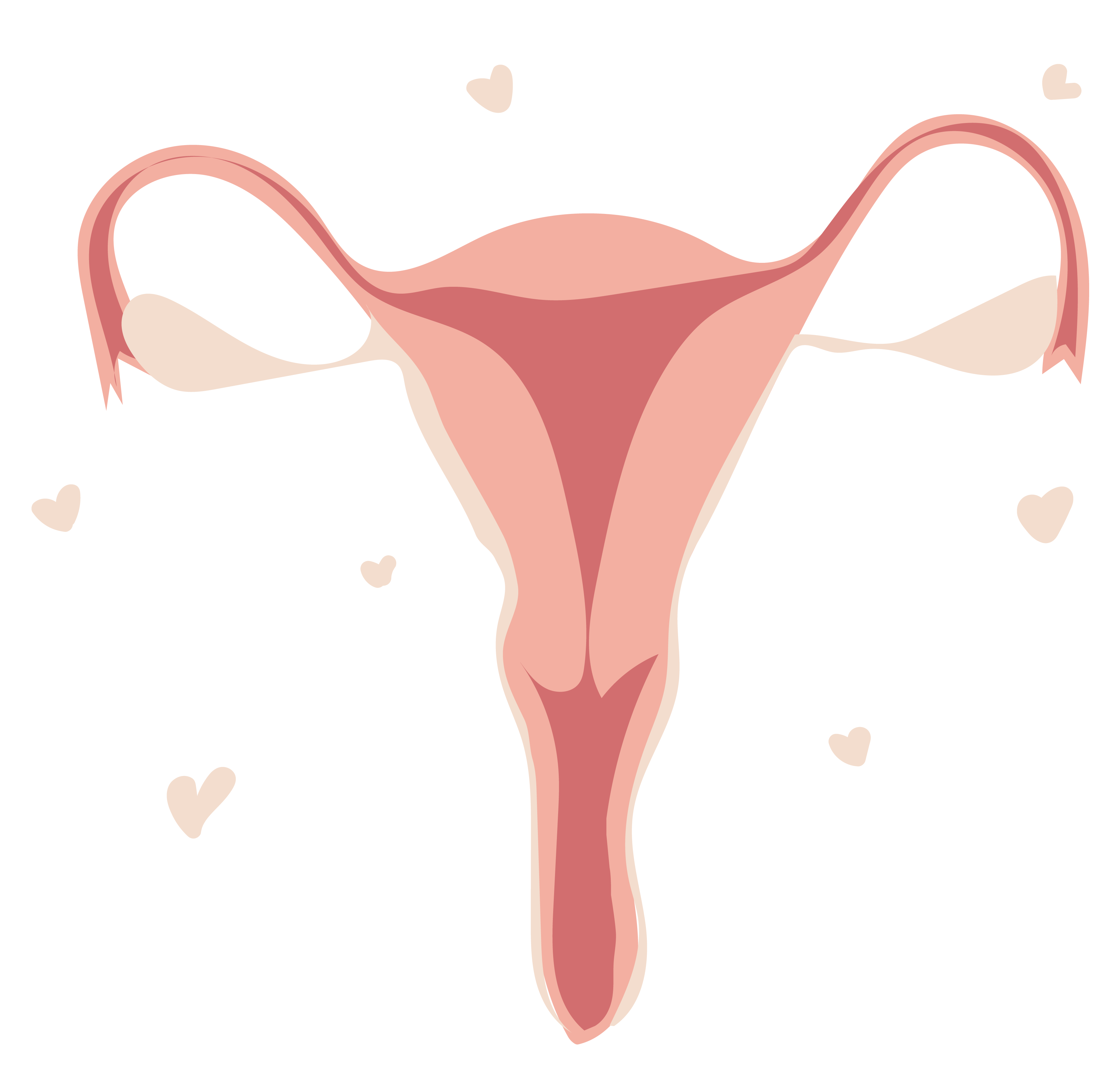 PCOS uterus illustration